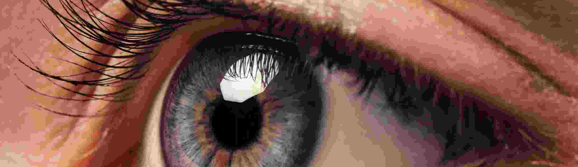 Occhion affeto da glaucoma
